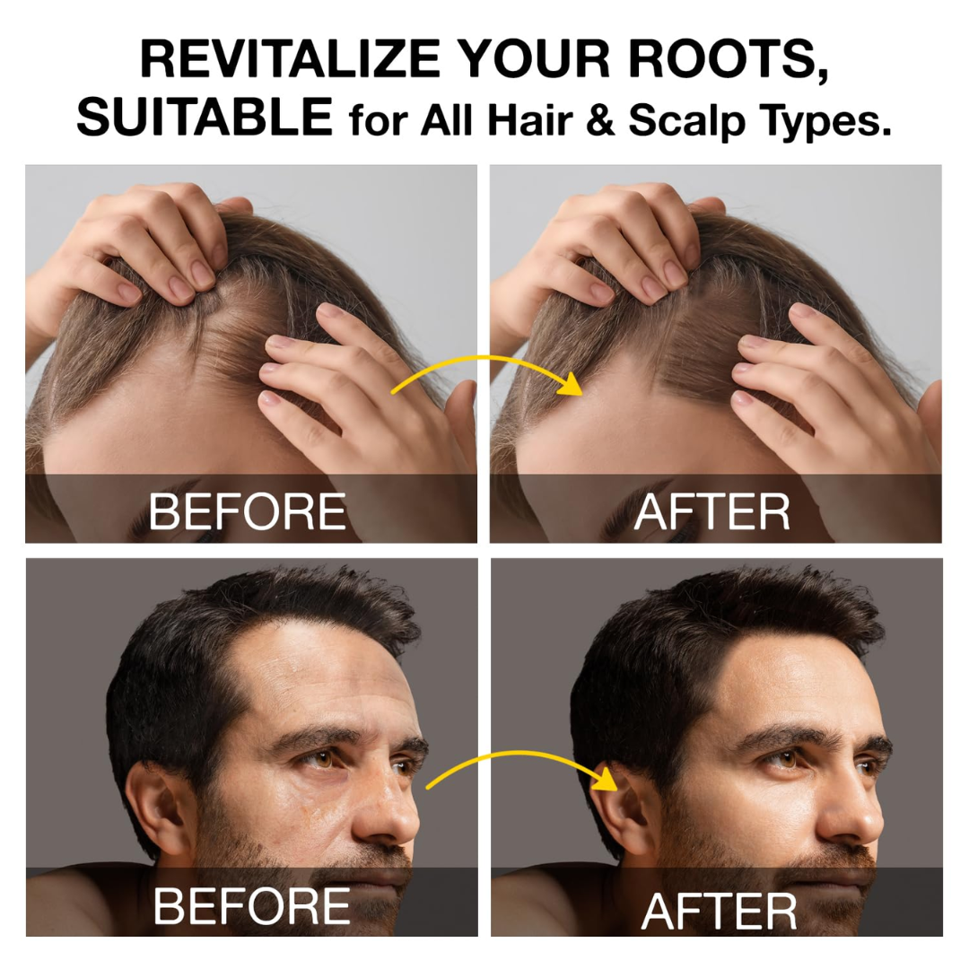 RootRevive Activator Shampoo for Men — Helps Reduce Breakage & Support Thicker-Looking Hair with 4 Washes/Week*